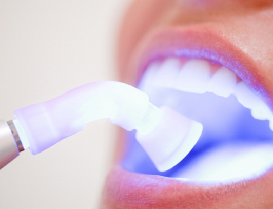 Laserterapia Odonto Vila Maria