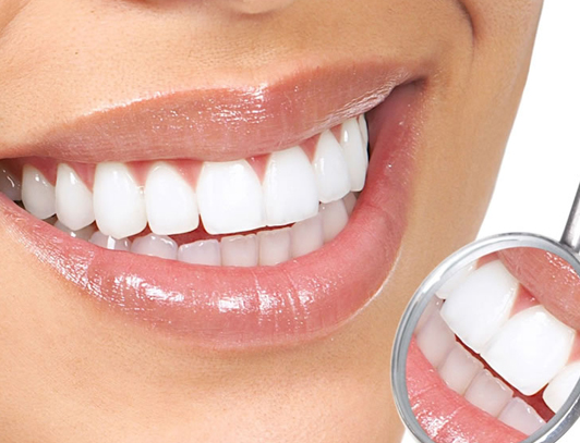 Lentes de Contato Odonto Vila Maria