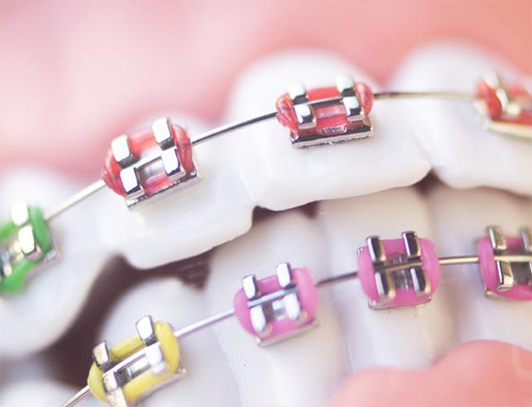 Ortodontia Odonto Vila Maria